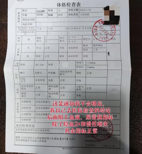 事業(yè)單位體檢什么情況下會(huì)不過(入職體檢嚴(yán)不嚴(yán))-圖1